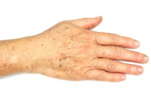 dont wring your hand over wrinkles 609a7954adcd7